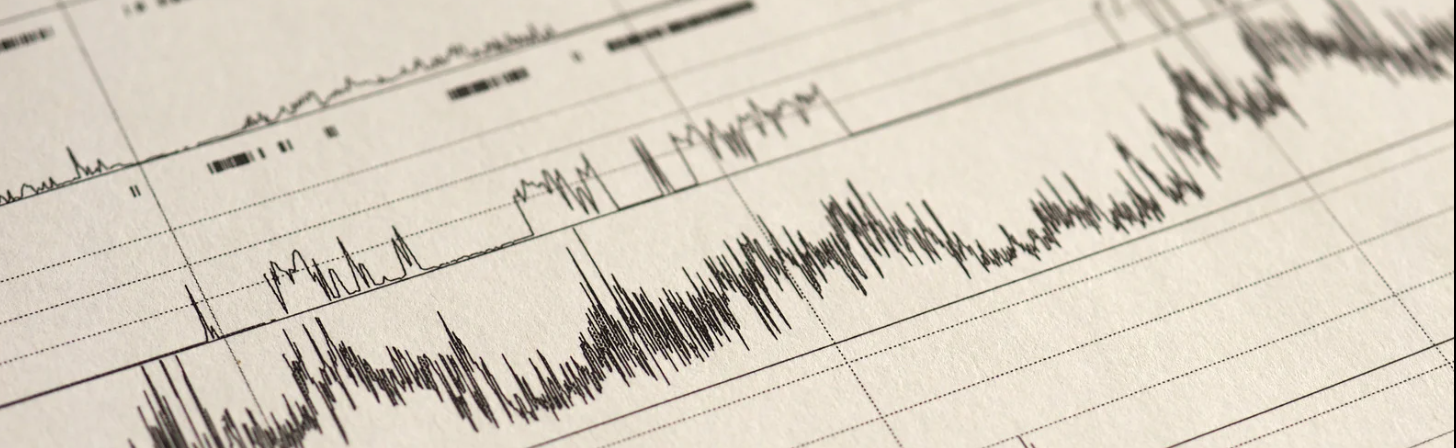 polysomnography